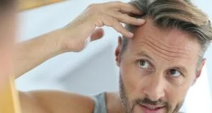 Baldness Problem