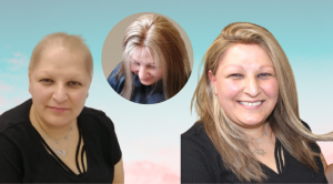 Menopoz Döneminde Saç Dökülmesi Olur mu?